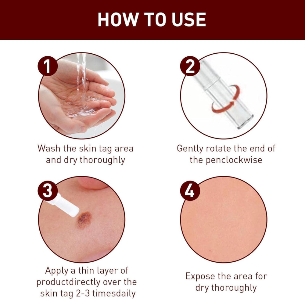 Liquid Wart and Skin Tag Removal