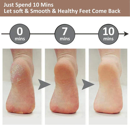 ELECTRIC PEDI CALLUS REMOVER
